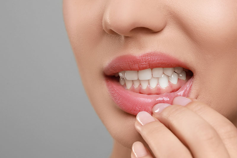 close up of inflamed gum