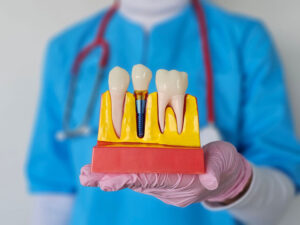 Dentist demonstrates dental implants and crown models in a clinical setting during consultation.