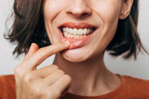 A woman lifts her upper lip to reveal her gums and teeth, highlighting oral health or gum issues, possibly for a dental examination or treatment awareness.