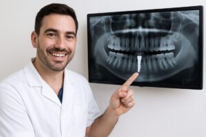 Image of a dentist smiling and pointing to a digital x-ray of a patient's mouth, highlighting a dental implant. The x-ray should show the implant integrated into the jawbone. No text on the image.